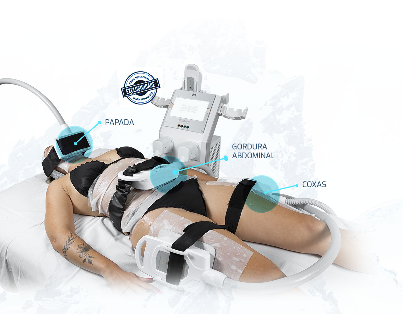 Polarys Plaxx aplicado em múltiplas áreas do corpo simultaneamente